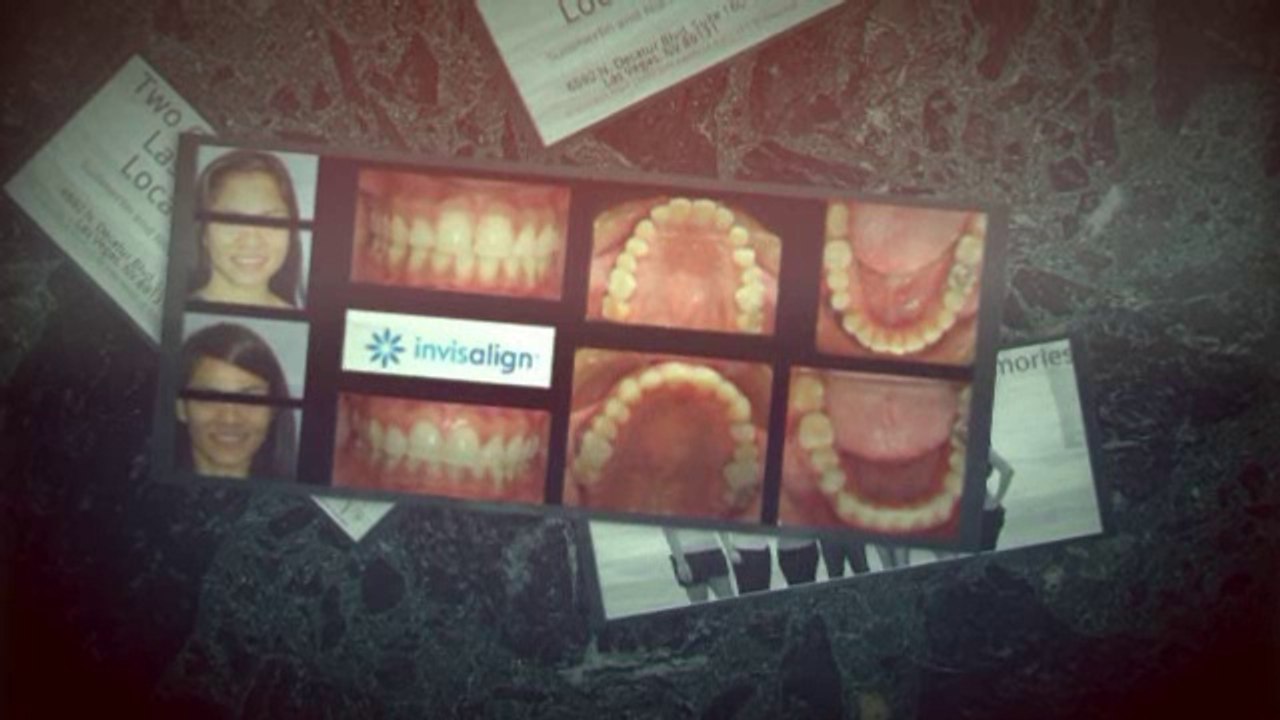 Braces Summerlin