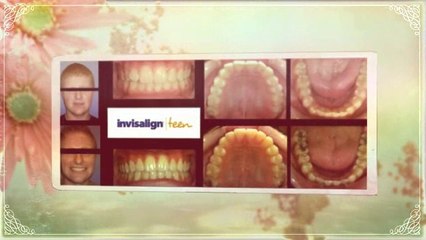 Summerlin Orthodontist