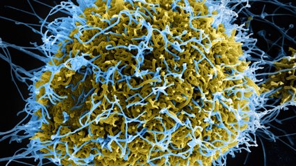 Fast Facts about the Ebola outbreak in Africa - July 29, 2014