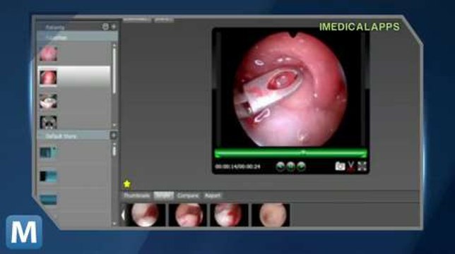 Endosync Lets Doctors Take a Look Inside from an iPad