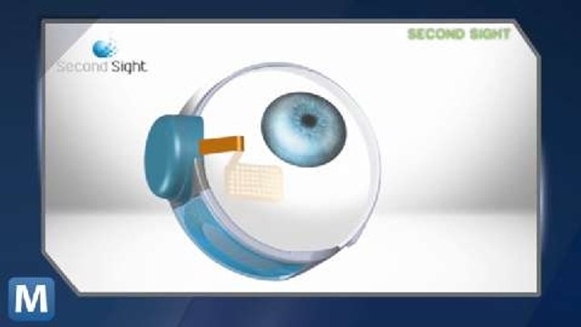 Implants Allows Visually Impaired to See Ordinary Text as Braille