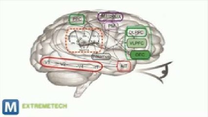 Scientists Create World’s Most Realistic Artificial Human Brain