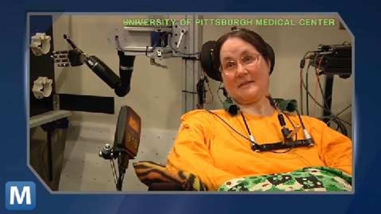 Woman Controls Robotic Arm with Her Brain