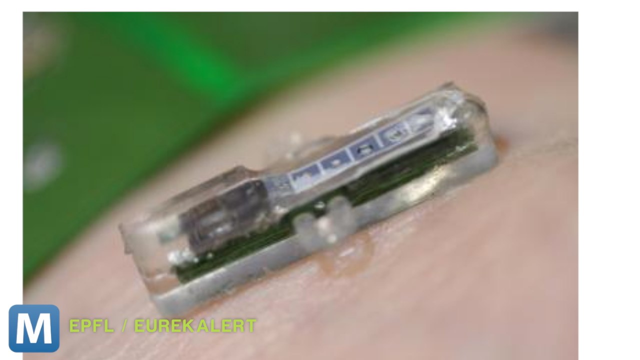 Researchers Developing Wireless Implant for Blood Testing