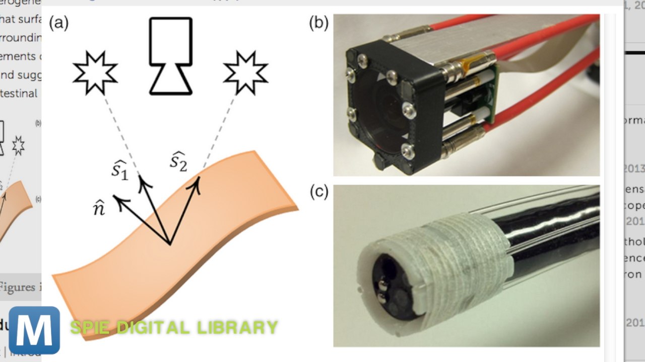 New Light-Based Detector Spots Cancer Faster
