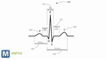 Apple Granted Patent for Embedded Heart Rate Monitor