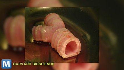 Researchers Work to Develop More Man-Made Organs