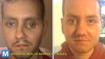 Surgical team Uses 3D Printing to Reconstruct Man’s Face