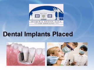 how dental implant procedure is done