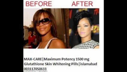 skin-whitening-pills-for-black-skin-glutathion-in-pakistan-karachi-multan-lahore-