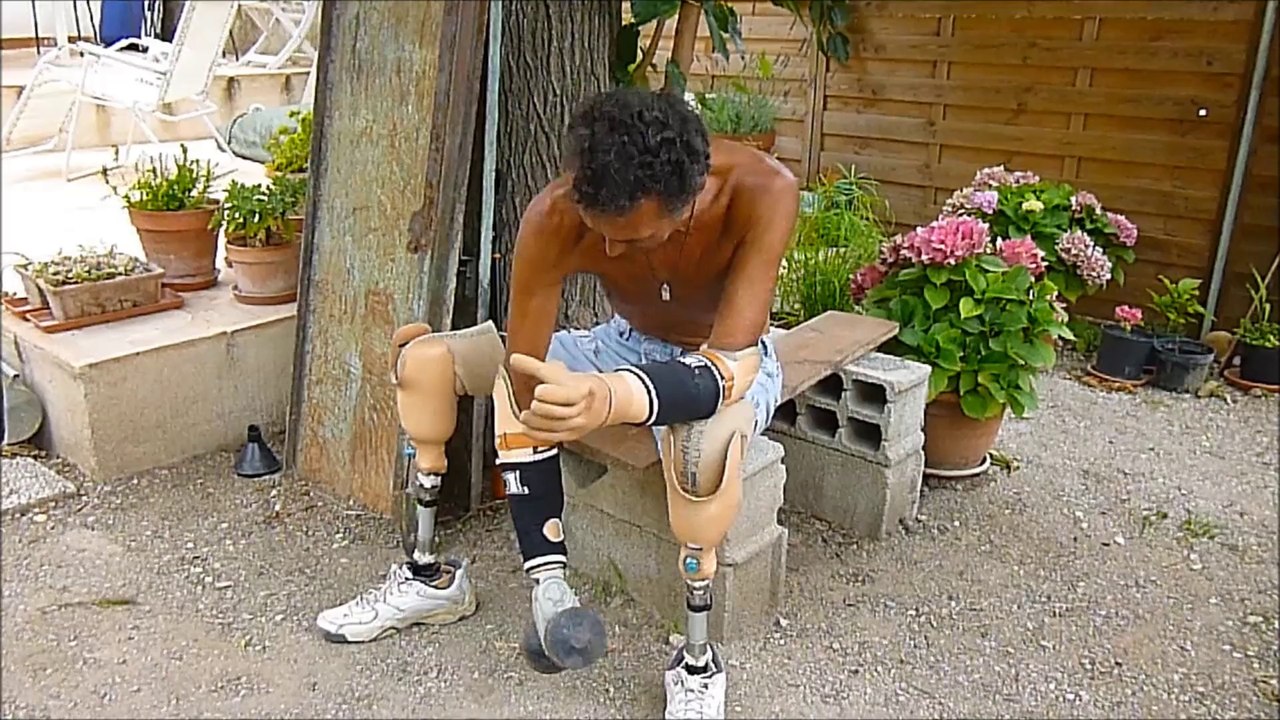 vidèo:prothèses et biceps