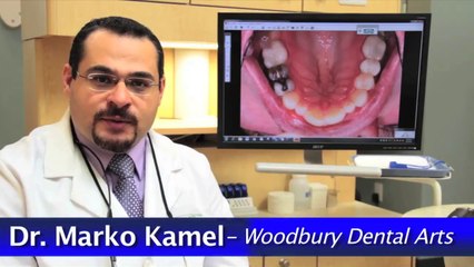 Do Mercury Fillings Cause Problems? Woodbury Dentist Explains www.woodburydentalarts.com