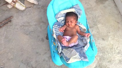 1 MONTH OLD BABY HAVING JAUNDICE TAKING SUNBATH