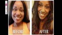 discover how I lost 40 pounds and lost weight