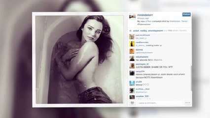 Miranda Kerr Posts Topless Photo