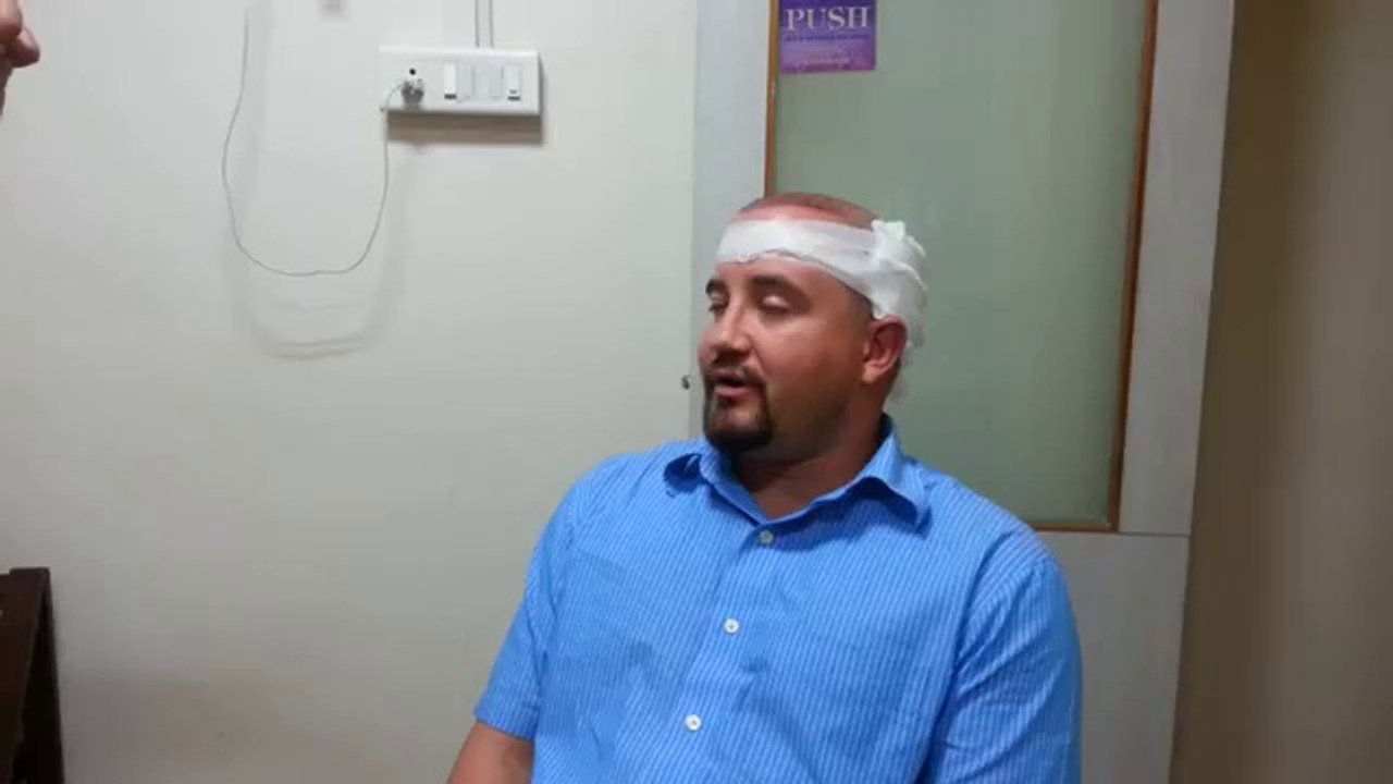 Advanse DHI FUE Hair Transplant Testimonial, Reviews - Skin and Surgery International ™