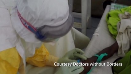 Doctors wary in their battle with deadly Ebola