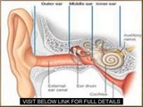 Tinnitus Natural Treatment Tinnitus Miracle Review Guide