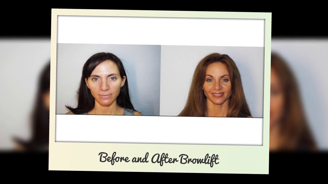 Cosmetic surgeon in Phoenix AZ as well as Scottsdale