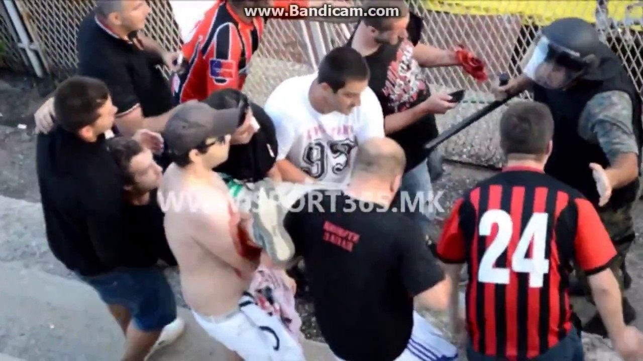 Soccer fan loses his hand by exploding police grenade
