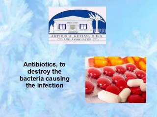 Causes And Treatment Of Abscess (Toothache)