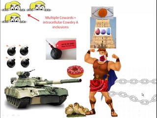 Truth About Genital Herpes