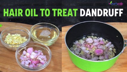 Treat Your Dandruff at Home Using Onion & Garlic