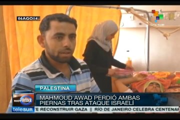 Miles de palestinos han debido ser amputados tras bombardeos israelíes