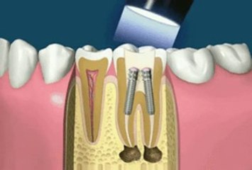 کاری که دندانپزشکان نامحترم با آن مردم را تلکه می‌کنند