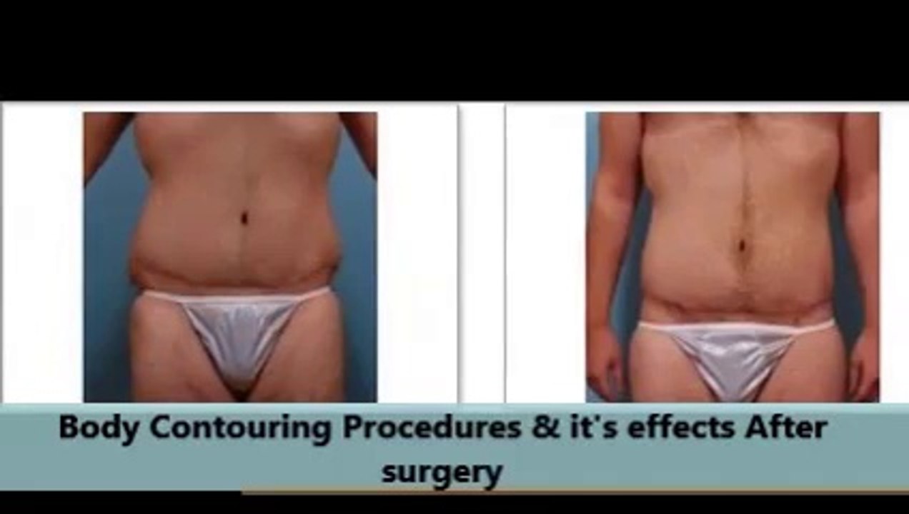 EBS Plastic Surgery : body procedures
