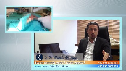 Download Video: Op. Dr. Mustafa Ali Yanık burun estetiği nedir ve nasıl yapılır ?=