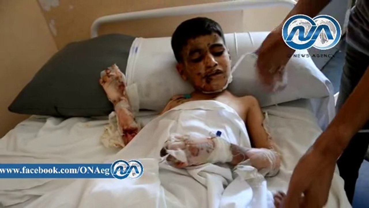 شاهد || "عبد الله" طفل فلسطينى استشهدت والدته وأُُُُصيب بحروق نسبتها أكثر من 50%‎