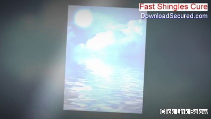 Fast Shingles Cure Review (See my Review)