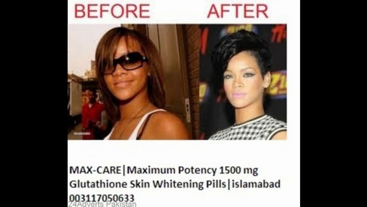 glutathione skin whitening pills for black skin in Pakistan-Call-03124484957