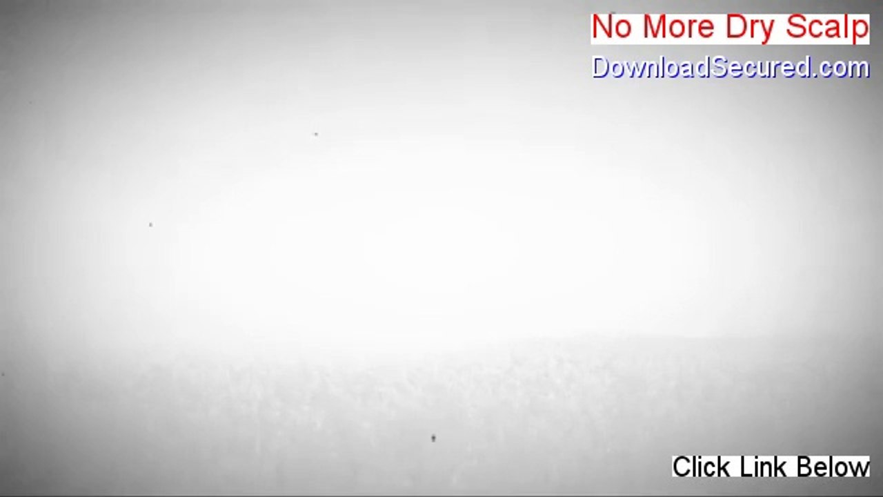 No More Dry Scalp Reviews (See my Review)