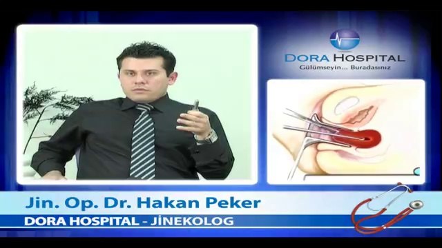 Kürtaj Nasıl Yapılır? - Fragman