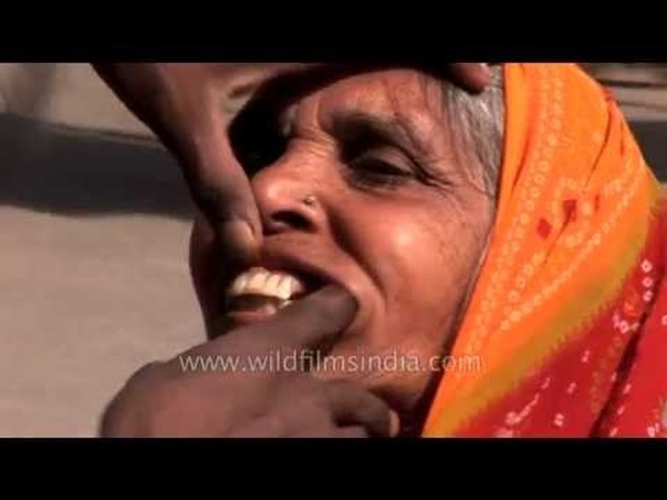Forget American dentists! Come to India and visit our roadside dentist!
