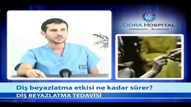 Diş Beyazlatma Etkisi Ne Kadar Sürer? - Fragman