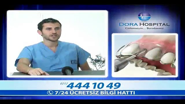 İmplant Tedavisinin Ömrü Ne Kadardır? - Fragman