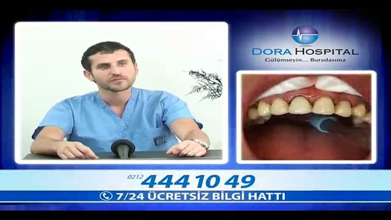 Laminate Protezlerin Ömrü Ne Kadardır? - Fragman