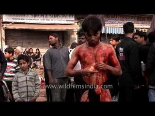 Severely injured man calmly eats an orange