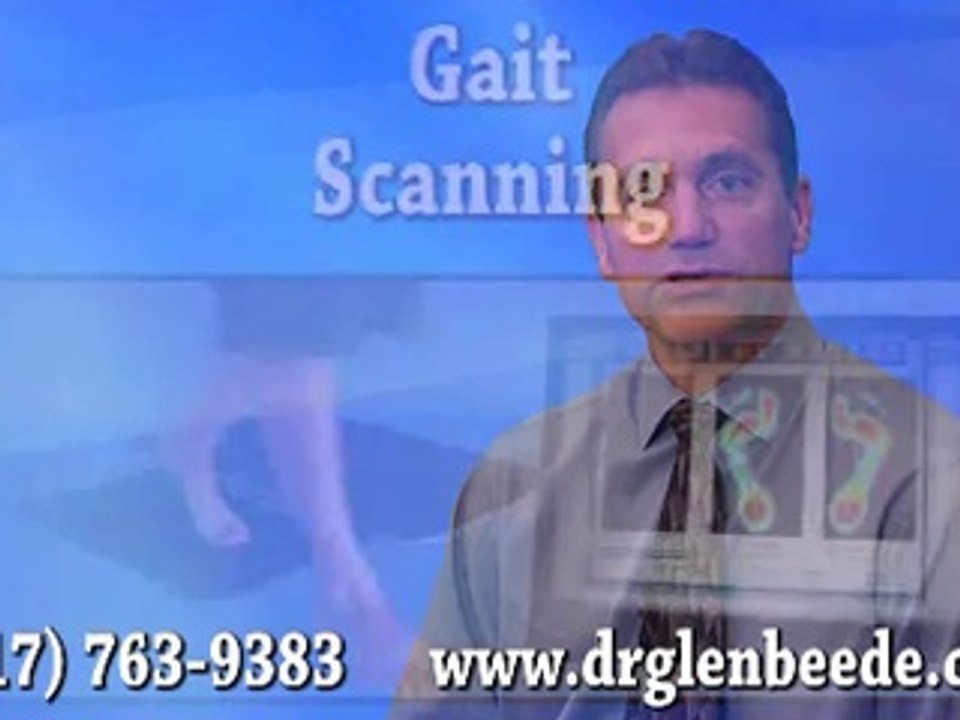 Fort Worth and Arlington, TX - Podiatrist Glen Beede - Custom Orthotics