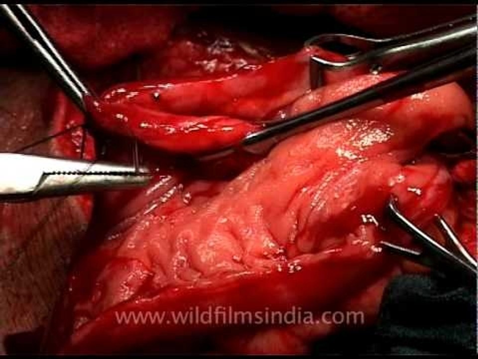Indian surgeons at work!