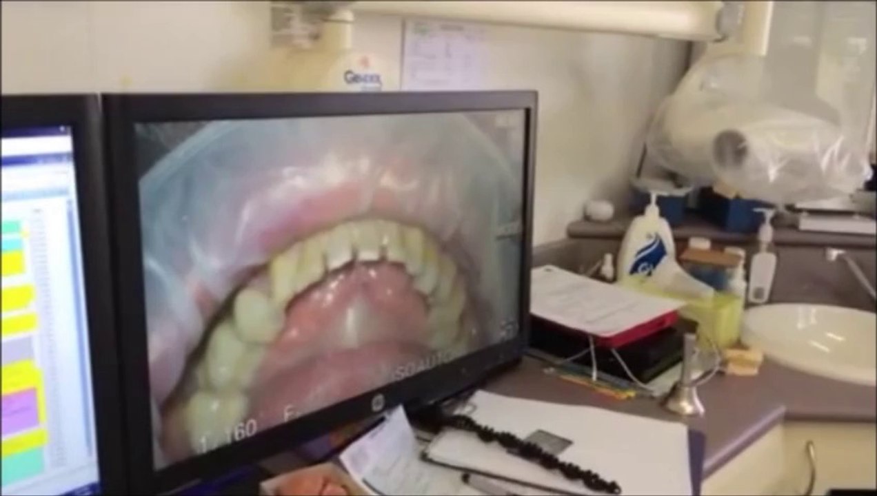 Microscope Dentistry by Dental Clinic Blackburn, Melbourne