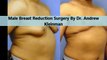 Kleinman Plastic Surgery Male Breast Reduction Procedure