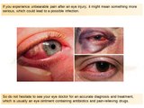 Arizona Eye Doctors Trivia - Arizona Retinal Specialists