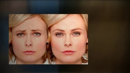 Tummy Tuck Beverly Hills
