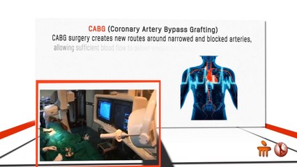 Manipal Hospitals in India for Top Heart Treatment