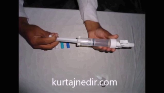 KÜRTAJ / Kürtaj Nedir, Kürtaj Nasıl Yapılır, Gebelik Sonlandırma, Kürtaj Öncesi Sonrası Video