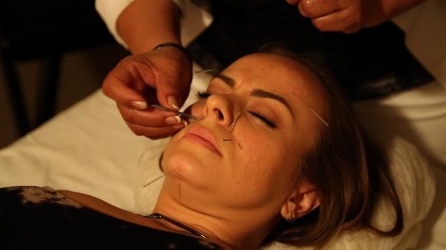 Allure Insiders - Can Cosmetic Acupuncture Make You Look Like Beyonce?